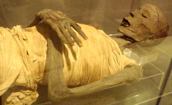 The Mummy of Upper Class Egyptian Male in Saite Period